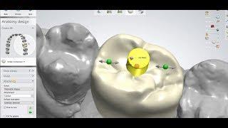 how you can make a digital hole for screw retained crown  in 3shape dental designer