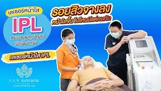 เลเซอร์ IPL หน้าใสจนใครใครก็ทักกับCCN BANGKOK CLINICพิจิตร