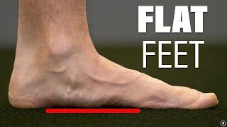 You Don’t Need To Fix Your Flat or Pronated Feet