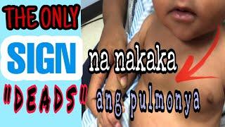 PULMONYA SA BATA| ang nakakatakot na senyales na nakakamatay ang UBO at mabilis na paghinga