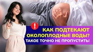 Как подтекают околоплодные воды во время беременности? ТАКОЕ ТОЧНО НЕ ПРОПУСТИТЬ!