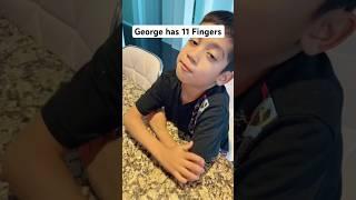 We Found Out Our Son Has an Extra Finger!! #short #shorts #shortsvideo