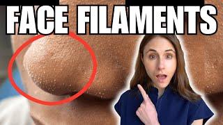 Sebaceous Filaments Vs Demodex Face Mites