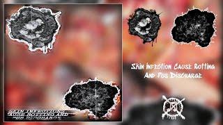 MxTxA//CxUxCx - Skin Infection Cause Rotting And Pus Discharge [Full Split] (Gorenoise)