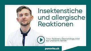 Insektenstiche richtig behandeln | puravita.ch – Ihre Online Drogerie in der Schweiz