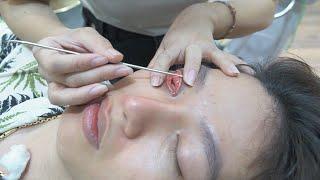 MARK MANH, a unique Vietnamese eye massage service nguyen hao vlog