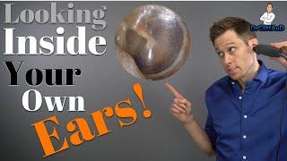 What's Inside Your Ears?  | Clogged Ears & Ear Problems | Natus Otocam 300