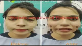 Rejuvena Cosmo Care - 500+ Surgery have done by Dr. Deepesh Goyal !! Best Plastic Surgeon