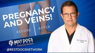 Watch: The Shocking Truth About Pregnancy & Your Veins - What Every Expectant Mother Needs to Know!