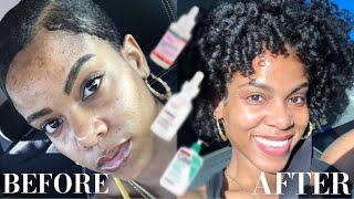 SKIN CARE UNDER $15! | HOW I'VE KEPT MY SKIN CLEAR | QUIESHA JAY