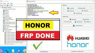  Honor X7a FRP Remove | RKY-LX2 | Honor FRP Key | Easy Way |#UnlockPrice