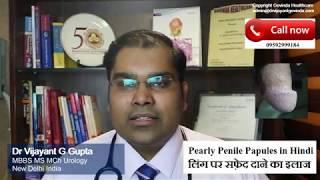 लिंग पे सफ़ेद दानो का लेज़र से इलाज | Pearly Penile Papules treatment in Hindi