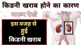 Kidney Failure Causes In Hindi | Kidney Kharab Hone Ke Karan | SELF DOCTOR