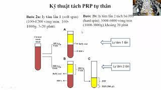 Liệu pháp huyết tương giàu tiểu cầu tự thân trong điều trị bệnh lý cơ xương khớp hiện tại và ...