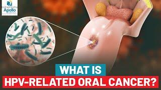 What Is HPV-Related Oral Cancer? | Oropharyngeal Cancer | Dr. Anil D'Cruz  | Apollo Hospital Delhi