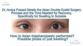 The Asian Double Eyelid Surgery Process and Why Temporary Swelling Occurs