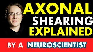 Axonal Shearing Explained | Cognitive FX