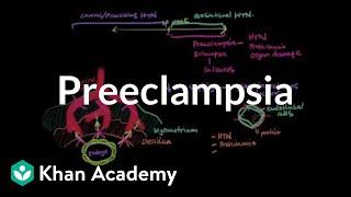 Preeclampsia | Reproductive system physiology | NCLEX-RN | Khan Academy