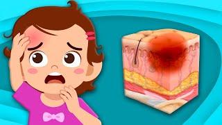 Discover How Bruises Happen! | Human Body Songs For Kids. | KLT Anatomy