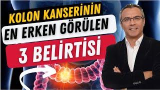 Kolon kanserinin EN ERKEN görülen 3 BELİRTİSİ