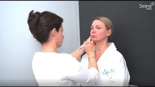 Thread Lifting Procedure at Seline Clinic | Performed by Dr. Tatyana Simonyan