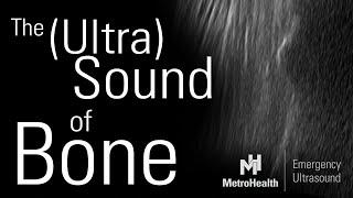 The (Ultra)Sound of Bone