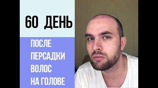 2 месяц или 60 день после пересадки волос на голове, Стамбул Турции.