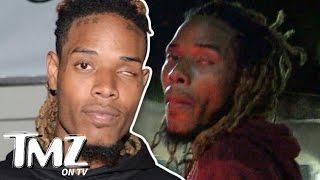 Fetty Wap- Eye Don’t Need No Stinkin’ Eye! | TMZ TV