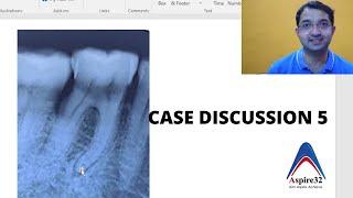 Short Case Discussion 5 | Reading Xrays | Aspire32