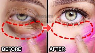 8MIN BEST EYE LIFTING EXERCISE FOR EYE BAGS, DARK CIRCLES UNDER EYES