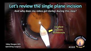 CataractCoach 1313: reviewing the single plane incision
