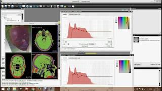 Outstanding Volume Visualization Software Demonstration by Anton Chulkov