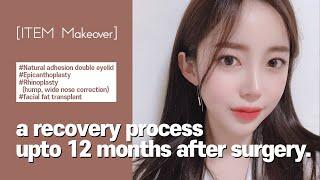 B&A | Double eyelid, Epicanthoplasty, Asian Rhinoplasty, Fat transplant  | Korean Plastic surgery