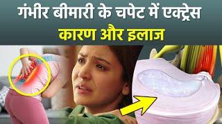 Anushka Sharma Suffers Bulging Disc: Kya Hai, Symptoms  & Causes | Boldsky