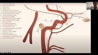 Middle Meningeal Artery Embolization for Chronic Subdural Hematoma Treatment, Chris Kellner, MD