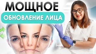 ЛАЗЕРНАЯ ШЛИФОВКА ЛИЦА | Что ПРОИСХОДИТ С ЛИЦОМ ПОСЛЕ лазерной шлифовки