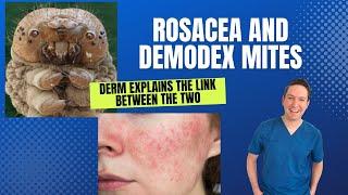 Dermatologist explains: Rosacea and the link with Demodex Mites: What can be done? #Rosacea #demodex