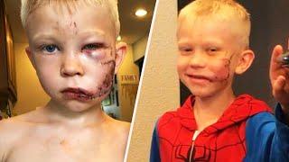 Boy Who Saved Sister in Dog Attack Gets Call from Spider-Man