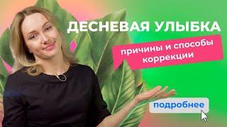 Десневая улыбка: почему это случается и как это исправить?