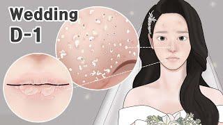 ASMR Wedding D-1 !! Pimple Popping, Blackhead Removal, Lip Scrub TOTAL SKINCARE ANIMATION  LULUPANG