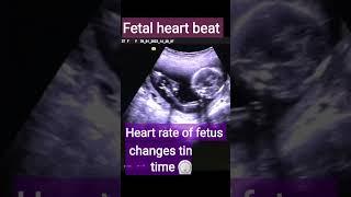 Fetal heart beat less than 140 is a baby boy /shorts