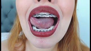 Latina braces girl giving braces and tongue closeup