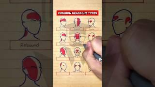 Common Types of Headaches