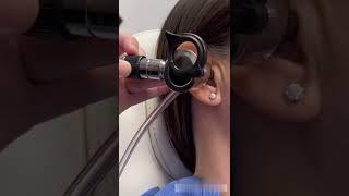 How an ENT Doctor Removes Ear Wax