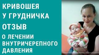 Внутричерепное давление у ребенка, лечение кривошеи - отзыв