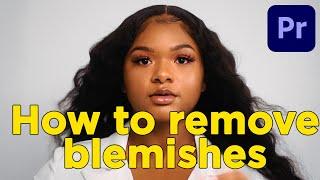 Tip Tuesday Ep.8: How to Remove Blemishes in Premiere Pro