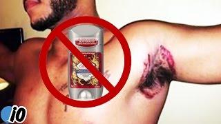 Old Spice Deodorant Is Leaving People With Bad Burns