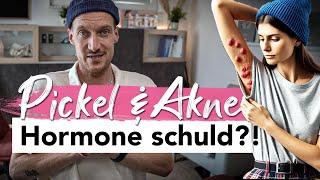 Überall Pickel? Sind Hormone schuld? Ist es Acne inversa? Tipps und Therapie