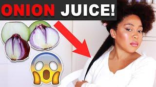 ONION JUICE FOR MASSIVE HAIR GROWTH! HOW TO USE ONION JUICE FOR SUPER FAST HAIR GROWTH!