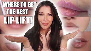 How to Find a Lip Lift Doctor